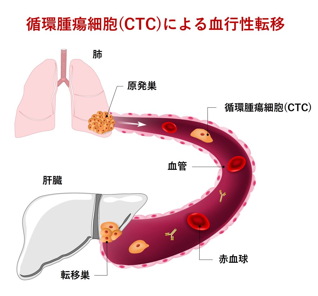循環腫瘍細胞(CTC)による血行性転移